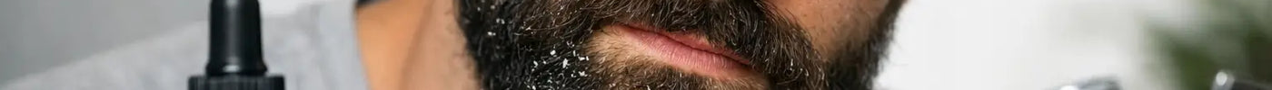 Does Beard Oil for Beard Dandruff Really Help?