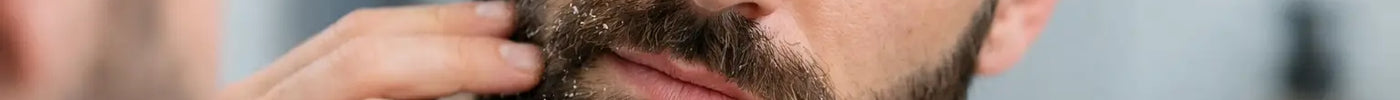 How to Fix Beard Dandruff for Good